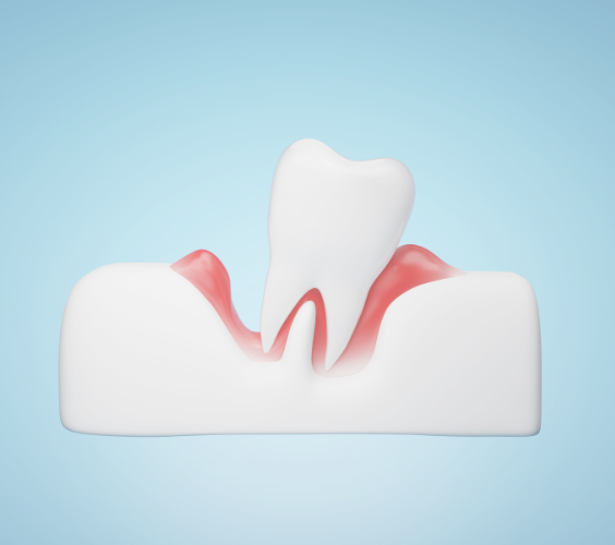 Beneficios Periodoncia