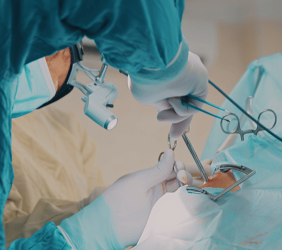 Beneficios de la cirugía oral